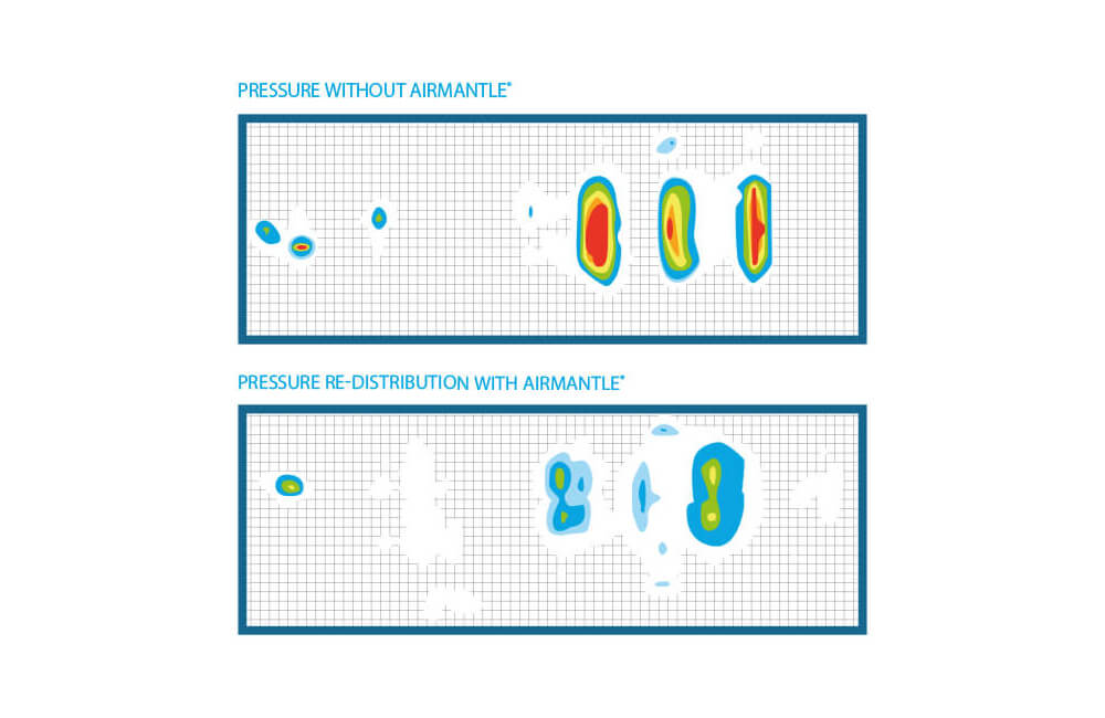 Hautschutz und Komfort mit Airmantle